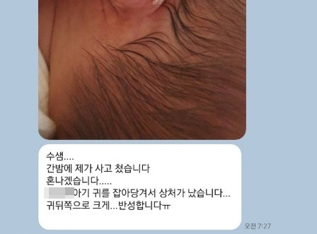 2021년 2월7일 새벽 부산 사하구의 한 산부인과 산후조리원에서 신생아 귀를 잡고 비트는 등 상해를 입힌 혐의를 받는 간호조무사가 사건 당일 오전 수간호사에게 보낸 메시지 내용. 피해 신생아 부모 제공