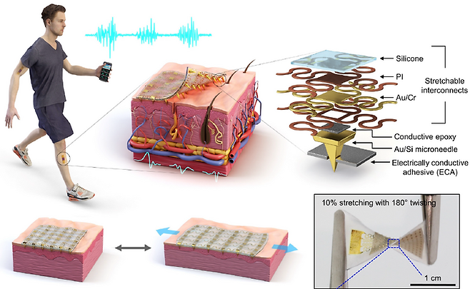 Figure 1. Design and working concept of the Stretchable microNeedle Adhesive Patch (SNAP). (A) Schematic illustration showing the overall system configuration and application of SNAP. (B) Exploded view schematic diagram of a SNAP, consisting of stretchable serpentine interconnects, Au-coated Si microneedle, and ECA made of Ag flakes–silicone composite. (C) Optical images showing high mechanical compliance of SNAP. [Courtesy of KIST]