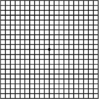 황반변성 자가 검사에 사용되는 ‘암슬러 격자’. 30~40cm 떨어진 곳에서 암슬러 격자를 바라봤을 때 ▲선이 휘어지거나 희미한 경우 ▲네모 칸 크기가 다른 경우 ▲일부 모서리가 보이지 않는 경우 ▲가운데 점이 보이지 않는 경우 황반변성을 의심해야 한다. / 사진= 헬스조선DB
