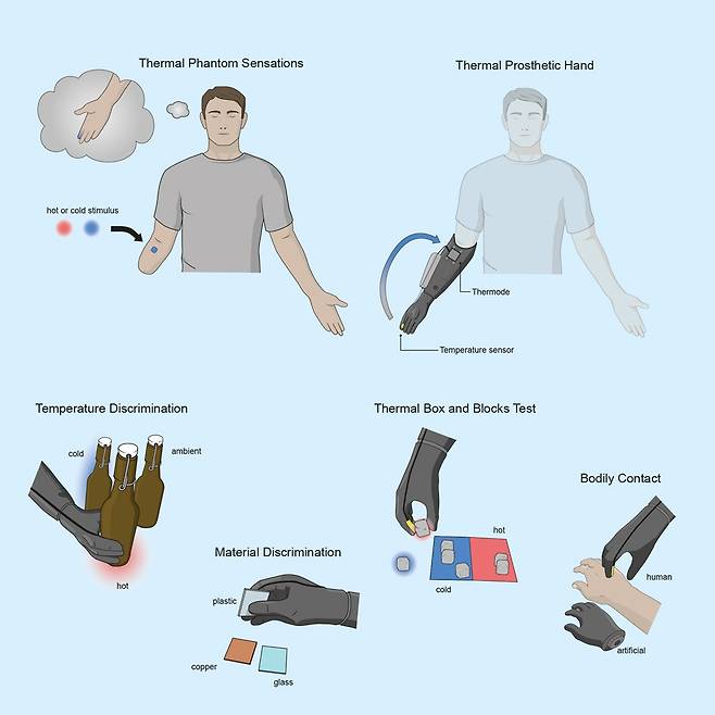 온도를 느끼는 의수 시스템 원리  [Med/Muheim and Iberite et al.제공. 재판매 및 DB 금지]