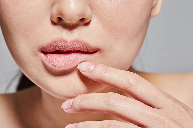 립밤은 바셀린, 시어버터, 밀랍, 히알루론산, 비타민E 등이 함유된 제품을 골라 사용해야 보습을 유지할 수 있다./사진=게티이미지뱅크