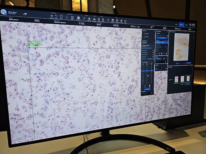 AI 분석 소프트웨어 '유패스'가 종양 세포를 감지한 화면 [촬영 김현수]