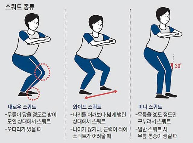 사진=헬스조선DB