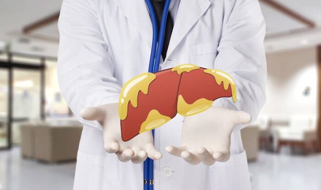 당뇨병과 비알콜성 지방간을 동시에 앓고 있는 환자는 심혈관 질환 위험이 모두 없는 사람에 비해 4.5배나 올라간다는 연구 결과가 나왔다. [사진=게티이미지뱅크]