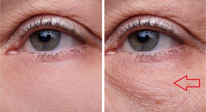 원래의 눈(왼쪽)과 '아이 백(Eye bag)'이 생겨 노화돼보이는 눈./사진=클립아트코리아