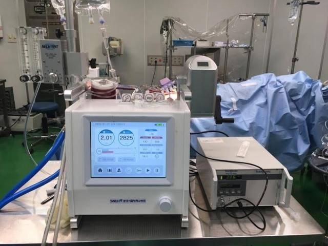 분당서울대병원 등 공동 연구팀이 국산화에 성공한 에크모(ECMO). 분당서울대병원 제공
