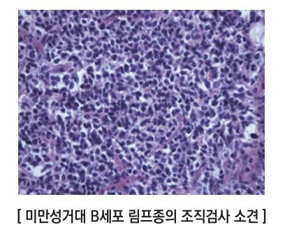 [대한혈액학회 제공]