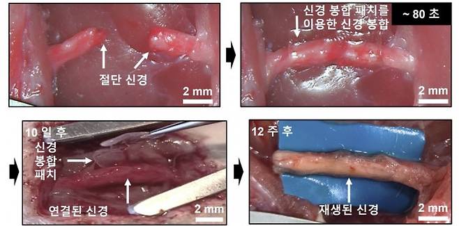 신경 봉합 패치를 이용한 신경 봉합 과정. 10일 후 신경이 연결되고 12주 후 완전히 재생된다. 한국연구재단 제공.