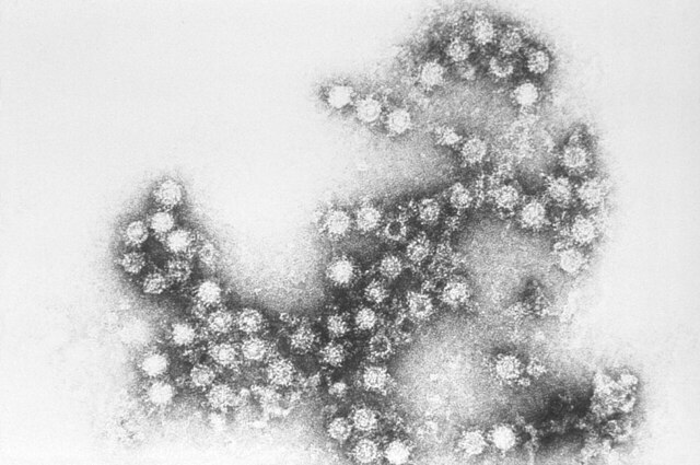 수족구병을 일으키는 ‘콕사키바이러스’ 모습. CDC