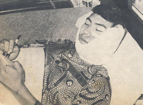 공연중 피습을 받고 얼굴에 72바늘을 꿰맨 나훈아.