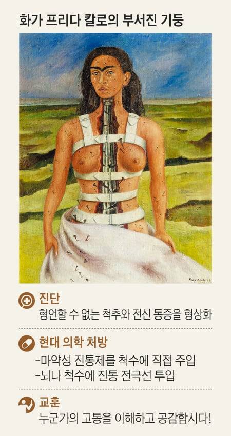 Frida Kahlo, Mexico, The Broken Column, ⓒMuseo Dolores Olmedo