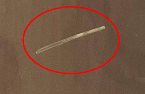 유명 떡갈비에서 나온 이물질은 식품의약품안전처 확인 결과 플라스틱처럼 뻣뻣한 1cm 길이의 돼지털이었다. / 사진=연합뉴스