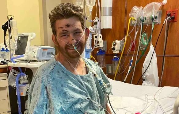 미국에서 사타구니 털을 직접 제거하려다 패혈성 쇼크에 빠진 한 남성이 생존율 4%를 뚫고 기적적으로 회복했다. [사진출처 = 뉴욕포스트]