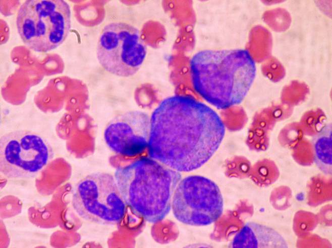 어빙 와이즈먼 미국 스탠퍼드대 병리학 및 발달생물학과 교수 연구진이 항체 치료법으로 노화한 조혈모세포를 없애 늙은 쥐의 면역체계를 젊은 상태로 되돌리는 데 성공했다. 사진은 골수에서 면역 세포를 만드는 조혈모세포와 백혈구./위키미디어