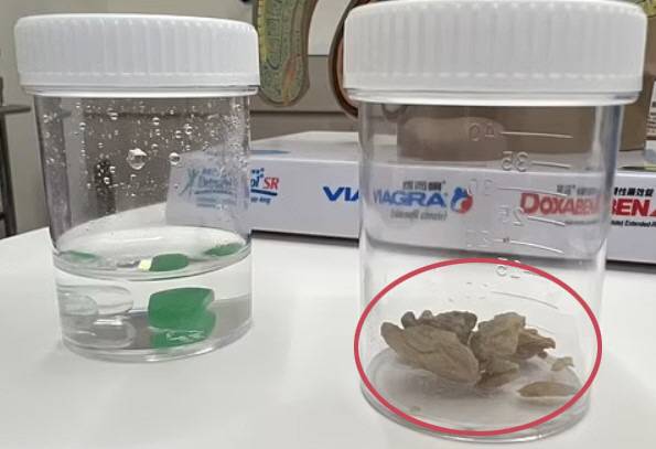 사진출처=데일리메일