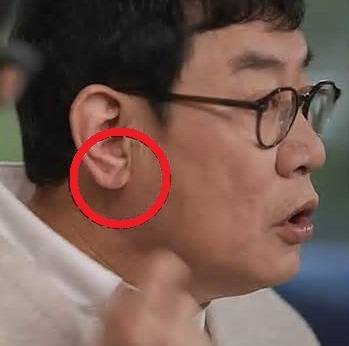 최근 예능인 이경규가 귓볼 주름 때문에 자기공명영상(MRI) 검사를 받은 사실을 공개했다. 유 퀴즈 온 더 블럭 화면 캡쳐