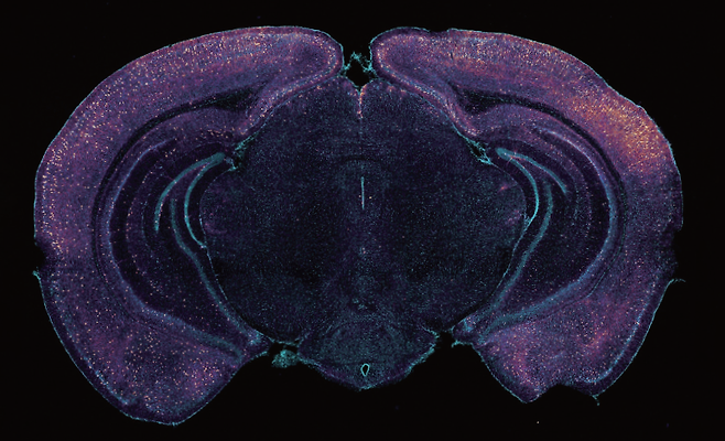 생쥐의 뇌 단면. 밝게 염색된 부분은 아밀로이드 베타 단백질을 제거하는 물질을 방출하는 신경세포이다. 아밀로이드 베타는 알츠하이머병을 유발한다. 사진 MIT