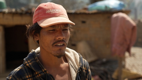 네팔 수도 카트만두 동부에 있는 카브레 지방은 일명 ‘신장(콩팥) 마을’로 불린다. 사진은 가난 때문에 인도로 건너가 불법으로 신장을 팔고 온 네팔 남성 수만(31). 사진=스카이뉴스