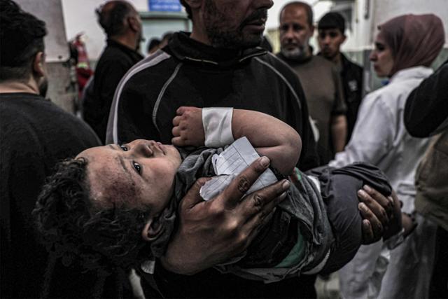 한 남성이 지난달 20일 가자지구 남부 도시 라파의 한 병원에서 이스라엘의 공습으로 부상 입은 어린이를 안고 있다. 라파=AFP 연합뉴스