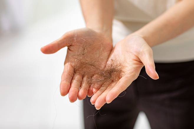 JW중외제약이 Wnt 표적 탈모치료제 JW0061에 대한 특허 국가를 확대하고 있는 가운데 최근 국내 특허를 획득했다. 사진은 기사와 직접적인 관련 없음. /사진=이미지투데이