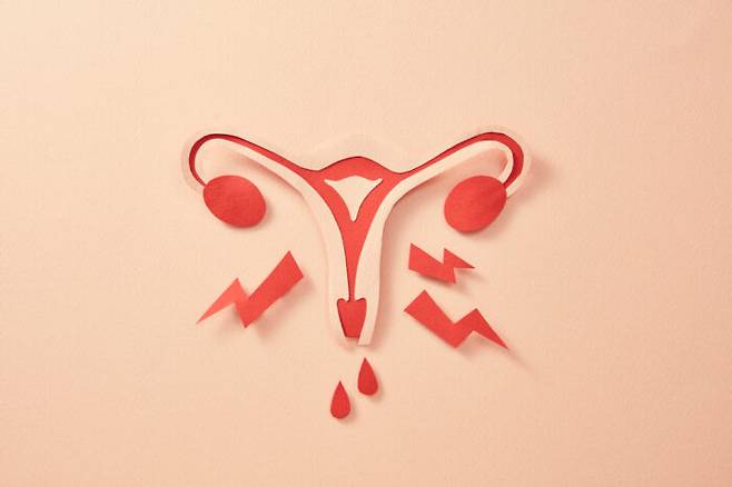 평소보다 생리통이 극심하거나 생리량에 급격한 변화가 있다면, 자궁질환을 의심해볼 필요가 있다. [사진=클립아트코리아]