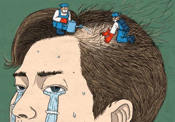 탈모 일러스트./조선비즈DB