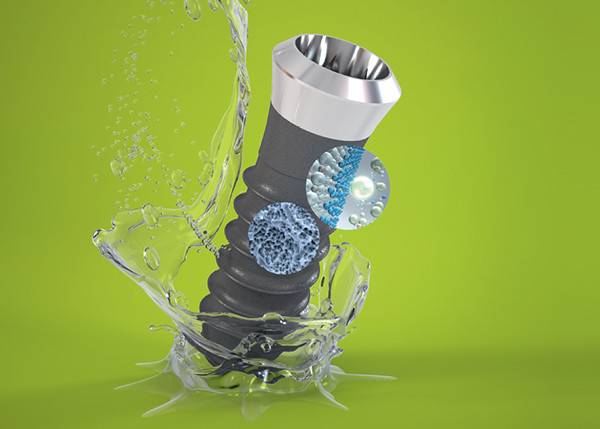 잇몸뼈의 양이 부족하거나 재수술 환자들이 많이 찾는 스트라우만 임플란트 사진제공|스트라우만