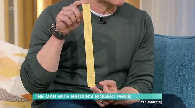 음경이 너무 커 생활이 불편한 경우 음경 축소술을 진행할 수 있다./사진=영국 방송 This Morning 캡처