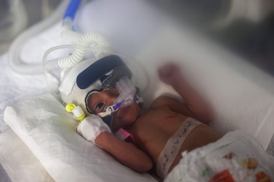 사망한 어머니의 뱃속에서 태어난 아기 루가 25일 사망했다. AFP=연합뉴스