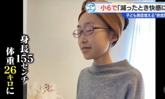 일본 아이치현에 거주하는 와타나베 유안(18)양은 초등학교 6학년 때부터 섭식 장애를 앓았다. [사진=일본 CBC 테레비 캡처]