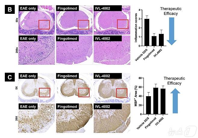 IVL4002 처리군에서 염증지표와 탈수초화를 유의미하게 감소시킨 효능 결과.(인벤티지랩 제공)/뉴스1ⓒ 뉴스1