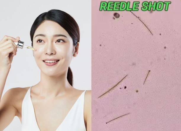 리들샷 화장품에 포함된 미세침이 피부에 침투하는 과정에서 재생을 촉진하고 유효성분을 효과적으로 전달한다. 왼쪽은 다이소 리들샷 300 제품을 현미경으로 100배 확대해 미세침을 포작한 것. [사진=클립아트코리아/유튜브채널 '보라색지구' 영상 캡처]