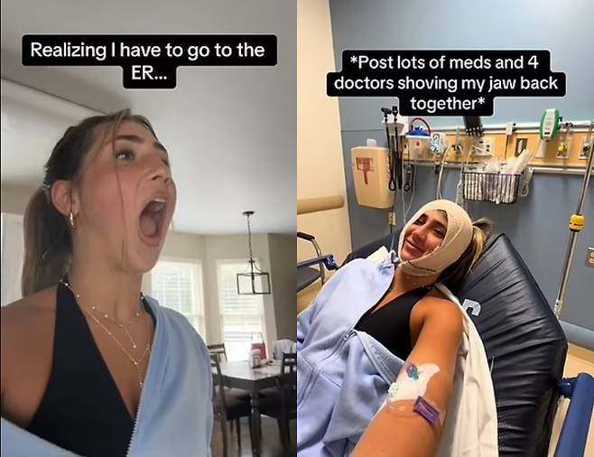 미국의 한 여성이 하품을 너무 크게 한 나머지 턱을 '닫을 수 없는' 지경이 되자 응급실로 향한 사연이 소개됐다. [사진=영국 데일리메일 보도 갈무리]