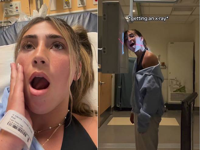 턱이 빠져 힘들어 하는 미국 20대 여성 제나의 모습(왼쪽)과 턱이 빠진 상태로 엑스레이 촬영을 하고 있는 제나./사진=더 선