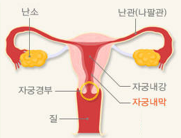 자궁의 입구인 자궁경부에 악성종양이 생기는 자궁경부암은 인유두종 바이러스가, 자궁 안쪽 막에 암이 발생하는 자궁내막암은 여성호르몬 불균형이 대표적 원인으로 지목된다. 보건복지부 제공