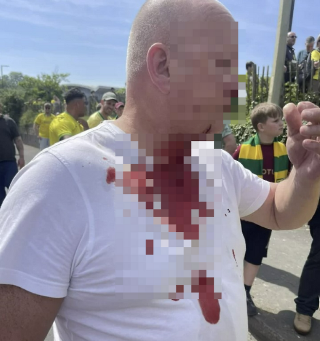 한 리즈 유나이티드팬이 비극적인 구호를 외치는 상대팀 팬무리에게 항의하다가 흉기에 목을 찔리는 사건이 발생했다. [사진 =텔레그래프]