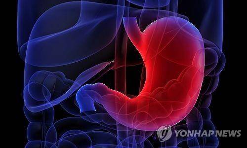 위암(일러스트)  제작 김민준