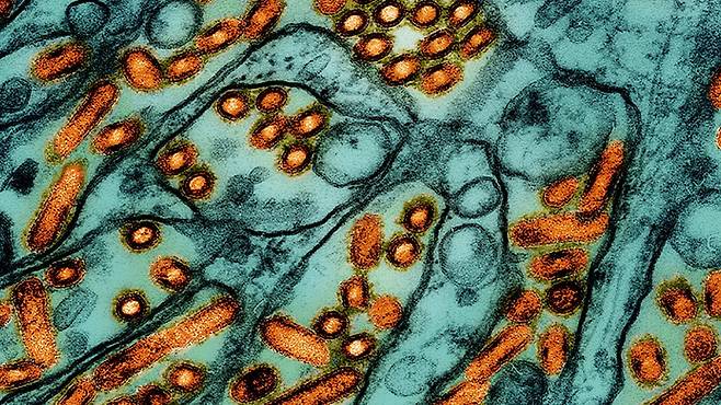 H5N1 조류 인플루엔자 바이러스 입자를 현미경으로 관찰한 사진(주황색)./CDC, 미국국립알레르기·전염병 연구소(NIAID)