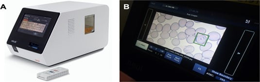 노을의 (A) 마이랩 디바이스와 카트리지, (B) 분석한 기생충 감염 적혈구를 화면에서 직접 볼 수 있다. 노을 제공