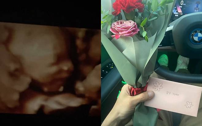 래퍼 빈지노가 공개한 아기 초음파 영상./사진=빈지노 인스타그램