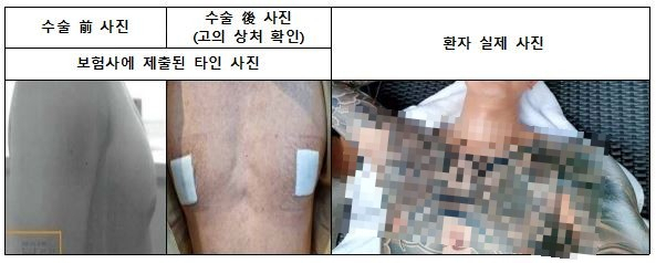 일당이 여유증 수술로 보험금을 받기 위해 보험사에 제출한 타인의 사진. [서울경찰청 광역수사단 형사기동대 제공]