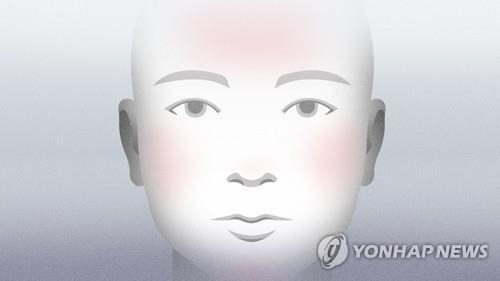 안면홍조 (PG) [강민지 제작] 일러스트