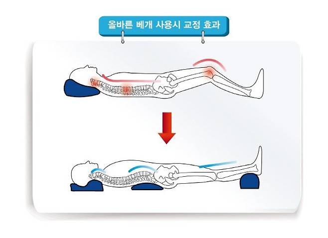 IMG_9187.jpeg 허리디스크 이유와 디스크 환자가 하지말아야 할 동작들