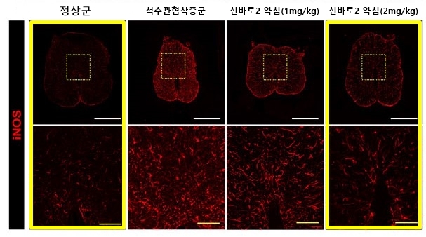 신바로2 약침 농도에 따라 붉은색으로 표시된 염증 매개 인자(iNOS)의 발현이 줄어드는 모습