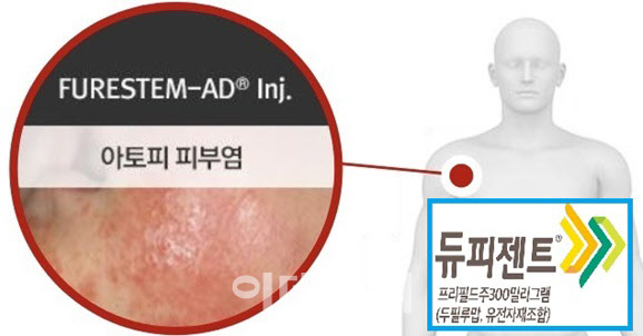 강스템바이오텍이 개발 중인 아토피 피부염 대상 줄기세포 신약 후보 ‘퓨어스템-에이디주’의 3상 결론이 이달 나올 예정이다. 해당 약물이 시장 선도 약물인 프랑스 사노피의 듀피젠트의 효능을 넘어설지가 관전 포인트다.(제공=한국리서치센터, 사노피)