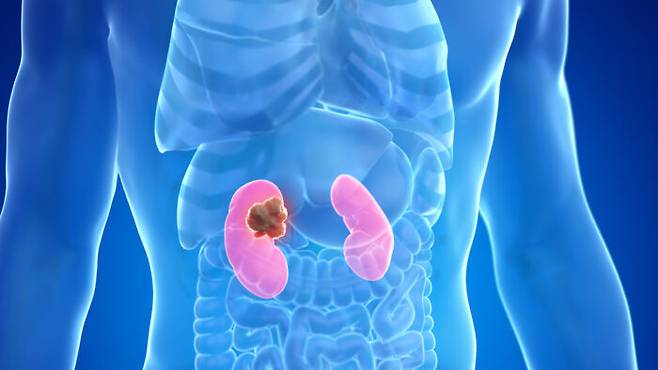 [사진=클립아트코리아]