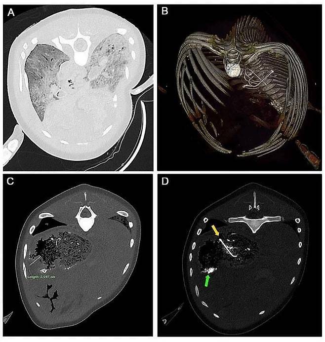 암컷 남방상괭이 사체의 사후컴퓨터 단층촬영(PMCT) 이미지. (A) 양쪽 폐에서 질식이나 폐렴에 걸렸을 때 나타나는 패턴이 관찰됐다.(B) 낚시 도구로 추정되는 이물질이 3D(입체) 영상에 포착됐다. (C)최대 폭이 2.6cm까지 두꺼워진 위장벽.(D) 위장에 낚싯바늘(노란색 화살표)과 고래회충 덩어리(녹색 화살표)가 나타났다./서울대