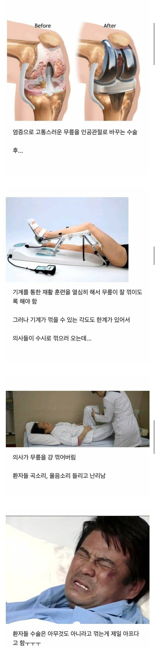 image.png 인공 관절 수술 후 느끼는 최악의 고통