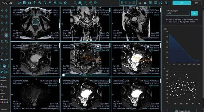 제이엘케이, 전립선암 진단 AI 솔루션 FDA 승인 (사진=제이엘케이 제공) *재판매 및 DB 금지