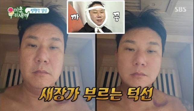 이상민의 턱밑 지방 흡입술 시뮬레이션 사진. [사진=SBS '미운 우리 새끼' 방송화면 캡처]
